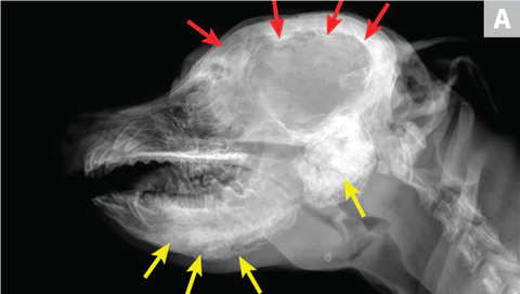 Craniomandibular Osteopathy