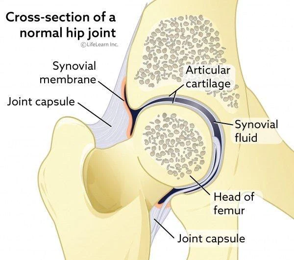 A diagram of a cross-section of a normal hip joint